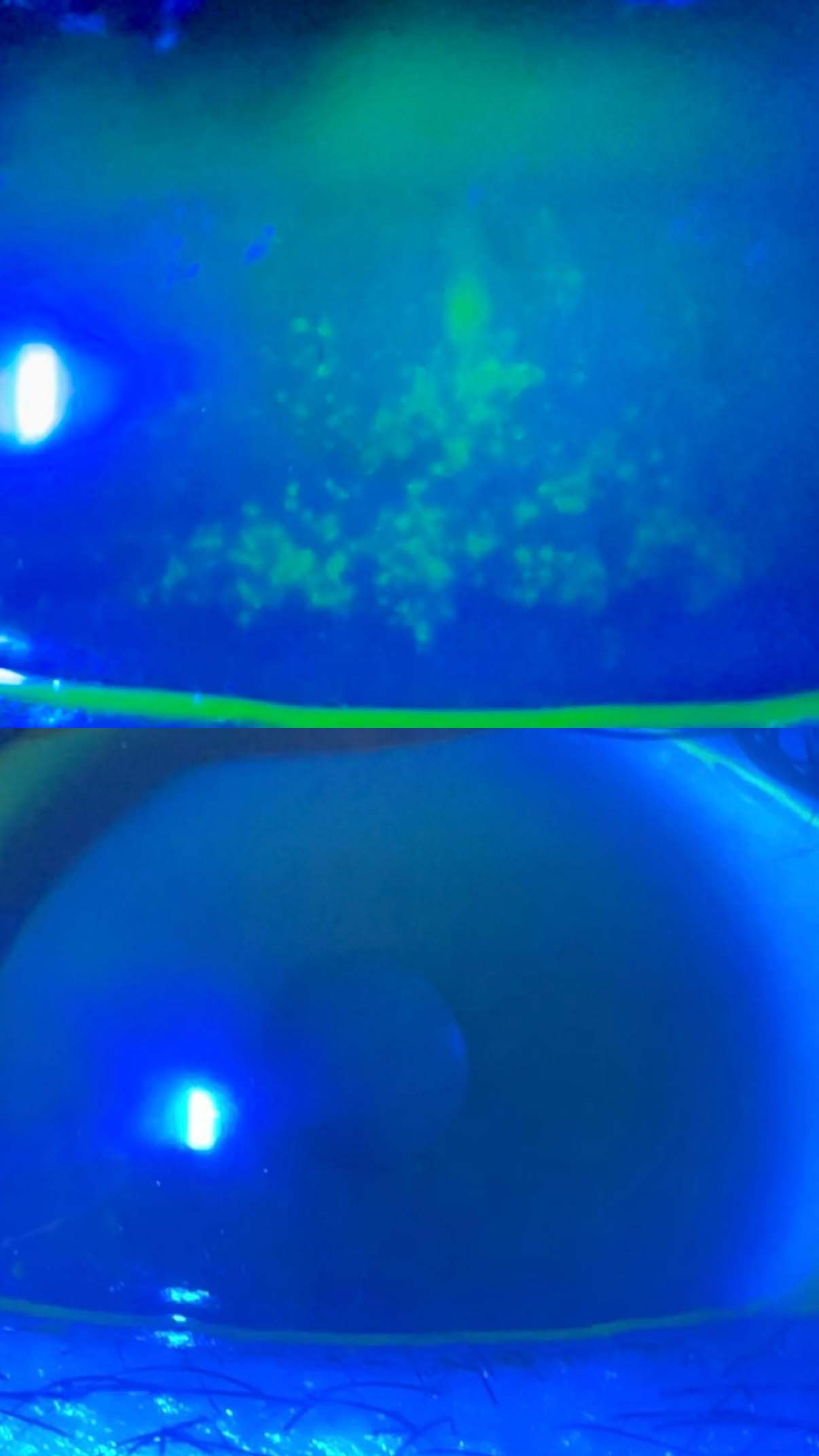 amnion scan