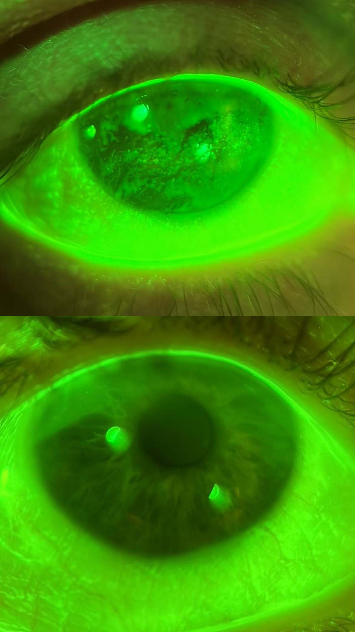 amnion scan