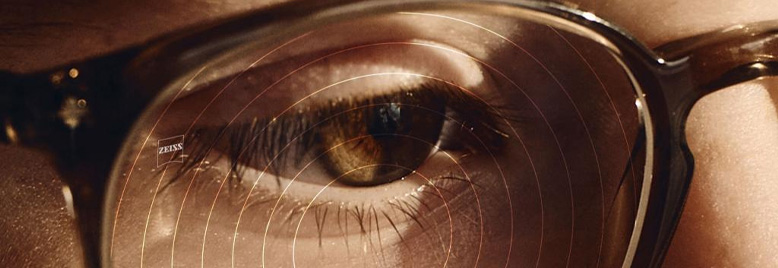 ZEISS MyoCare